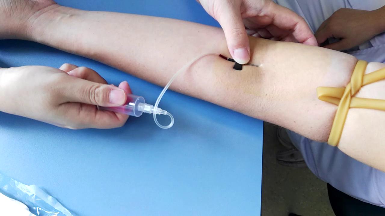 passive pressure pulse hemostatic patch